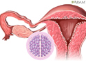 Formation of twins - Animation
                    