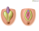 Sexual differentiation - Animation
                    