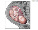 The role of amniotic fluid - Animation
                    