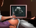 Ultrasound - Video
                                      