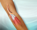 What is tennis elbow? - Animation
                    