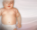 Gastroesophageal reflux in infants