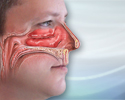 Nasal congestion - Animation
                    