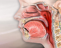 Pharyngitis - Animation
                    