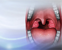 Tonsillectomy - Animation
                    