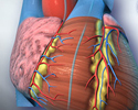 Cardiac catheterization - Animation
                    