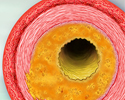 Cholesterol and triglyceride test - Animation
                    