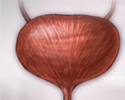 Urinary tract infection - adults - Animation
                    