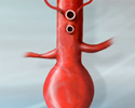 Abdominal aortic aneurysm - Animation
                    