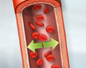 Hypertension - Animation
                    