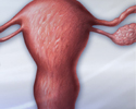 Hysterectomy - Animation
                    