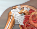 Rotator cuff problems - Animation
                    