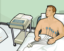 Cardiac arrhythmia tests: ECG and EKG