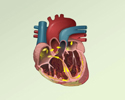 Atrial fibrillation overview - Animation
                        