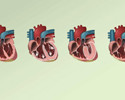 Cardiomyopathy overview - Animation
                        