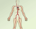 Congestive heart failure (CHF) overview - Animation
                        