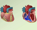 Congenital heart defects (CHD) overview - Animation
                        