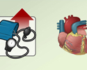 Cardiac hypertension hypertrophy - Animation
                        
