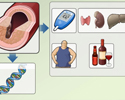 Types of hyperlipidemia - Animation
                        