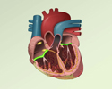 Cardiac conduction system disorders - overview - Animation
                        