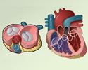 Valvular heart disease (VHD) - overview - Animation
                        