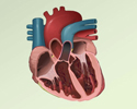 Ventricular fibrillation and tachycardia - Animation
                        