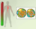 Heart disease modifiable risk factors - hyperlipidemia - Animation
                        