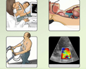 Types of echocardiography - Animation
                        
