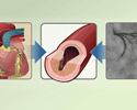 Cardiac catheterization - uses in diagnosis, evaluation and treatment