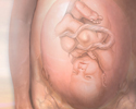 C-section - Animation
                    