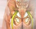 Sciatica - Animation
                    