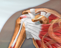 Shoulder pain - Animation
                    