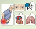 Causes and side effects of acute pain - Animation
                        