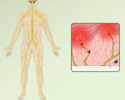 Nociceptive pain - Animation
                        