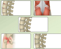 Common causes of low back pain - Animation
                        