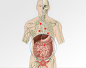 How cancer spreads through the body - Animation
                        