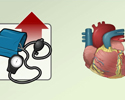 Cardiac hypertension hypertrophy - Animation                        