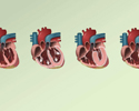 Cardiomyopathy overview - Animation                        