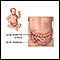 Obstrucción intestinal (pediátrico) - serie