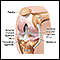 Artroscopia de rodilla - serie - Anatomía normal