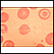 Glóbulos vermelhos, células em alvo