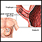 Acalasia - serie