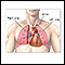 Heart-lung transplant - series - Normal anatomy