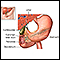 Endoscopic retrograde cholangio pancreatography (ERCP) - series