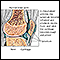 <div class=media-desc><strong>Rheumatoid arthritis</strong><p>Rheumatoid arthritis is a systemic autoimmune disease which initially attacks the synovium, a connective tissue membrane that lines the cavity between joints and secretes a lubricating fluid.</p></div>