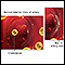 Blockage in internal carotid artery