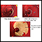 <div class=media-desc><strong>Arterial plaque build-up</strong><p>The build-up of plaque in the inner layer of the wall of an artery may lead to narrowing and irregularity. Where the narrowing is severe, there is a risk that the vessel can block completely if a thrombus forms in the diseased segment.</p></div>