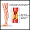Arteriosclerosis de las extremidades