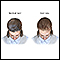<div class=media-desc><strong>Female-pattern baldness</strong><p>Female-pattern baldness is a pattern of hair loss (alopecia) caused by hormones, aging and genetics. Unlike male-pattern baldness, female-pattern baldness is an over-all thinning which maintains the normal hairline.</p></div>