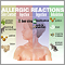 Allergic reactions